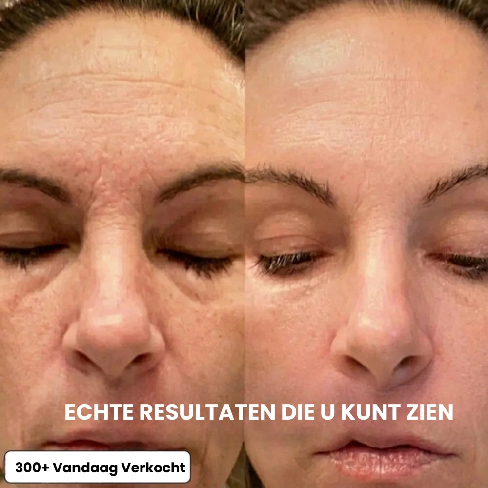 Binnen de …